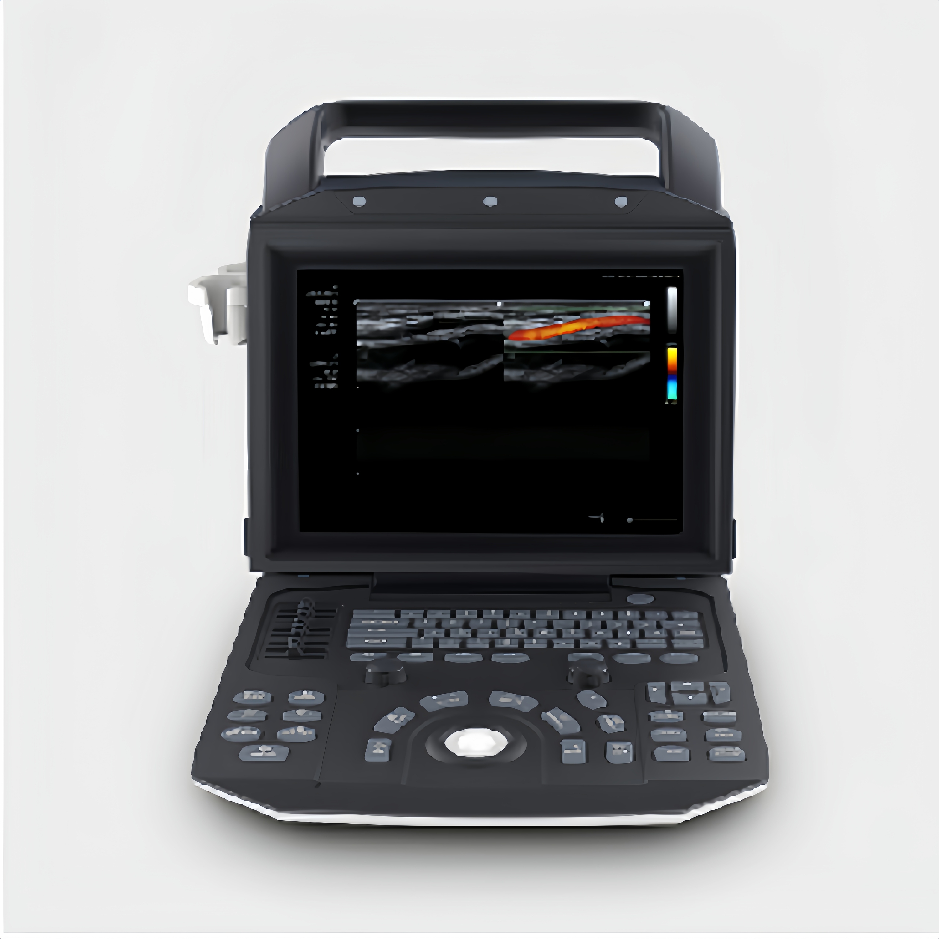 Good Quality color Ultrasound Diagnostic Ultrasound Scanner B Ultrasound Medical Full Digital Diagnostic System for M5