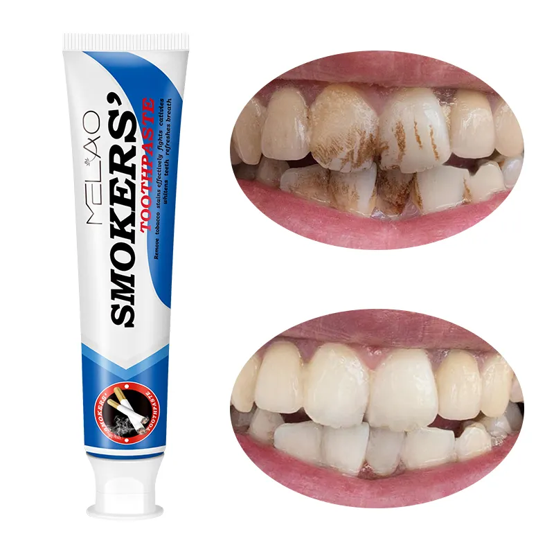 Smokers Toothpaste Stain Removing Teeth Whitening Toothpaste For Smokers Coffee Lovers