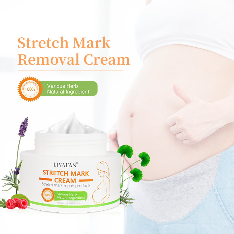 Wholesale Natural Organic Skin Care Scar Repair Stretchmark Abdomen Body Stretch Mark Removal Cream