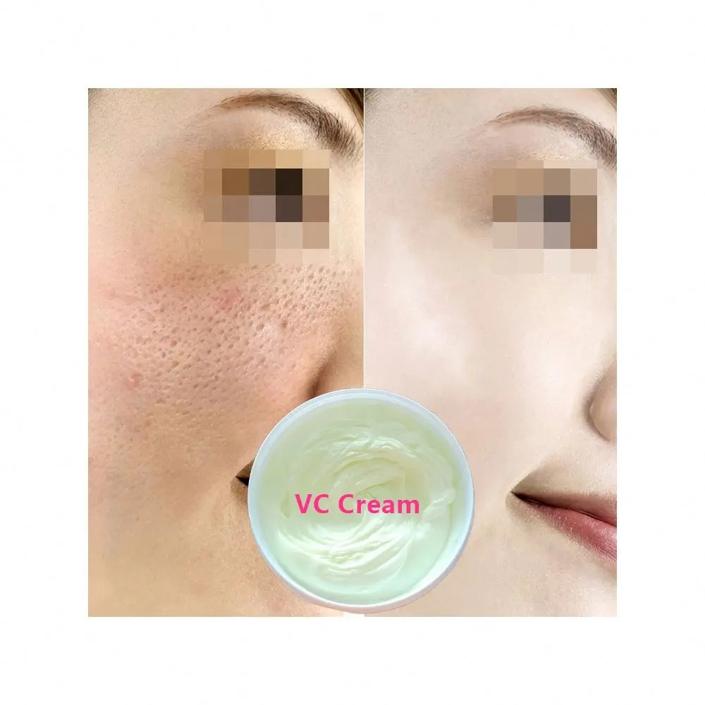 Natural Facial Whitening Cream Remove Dark Spots Anti Freckles Brightening Skin Vitamin C Face Cream