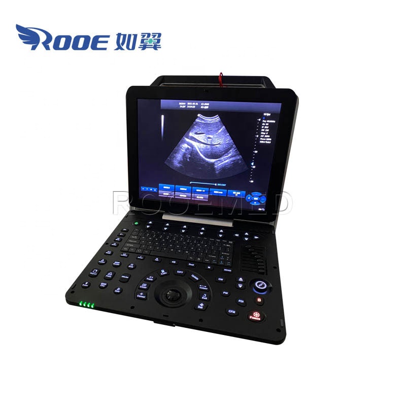 USC300PRO Medical Portable Scan Cardiac Color Doppler Ultrasound Machine