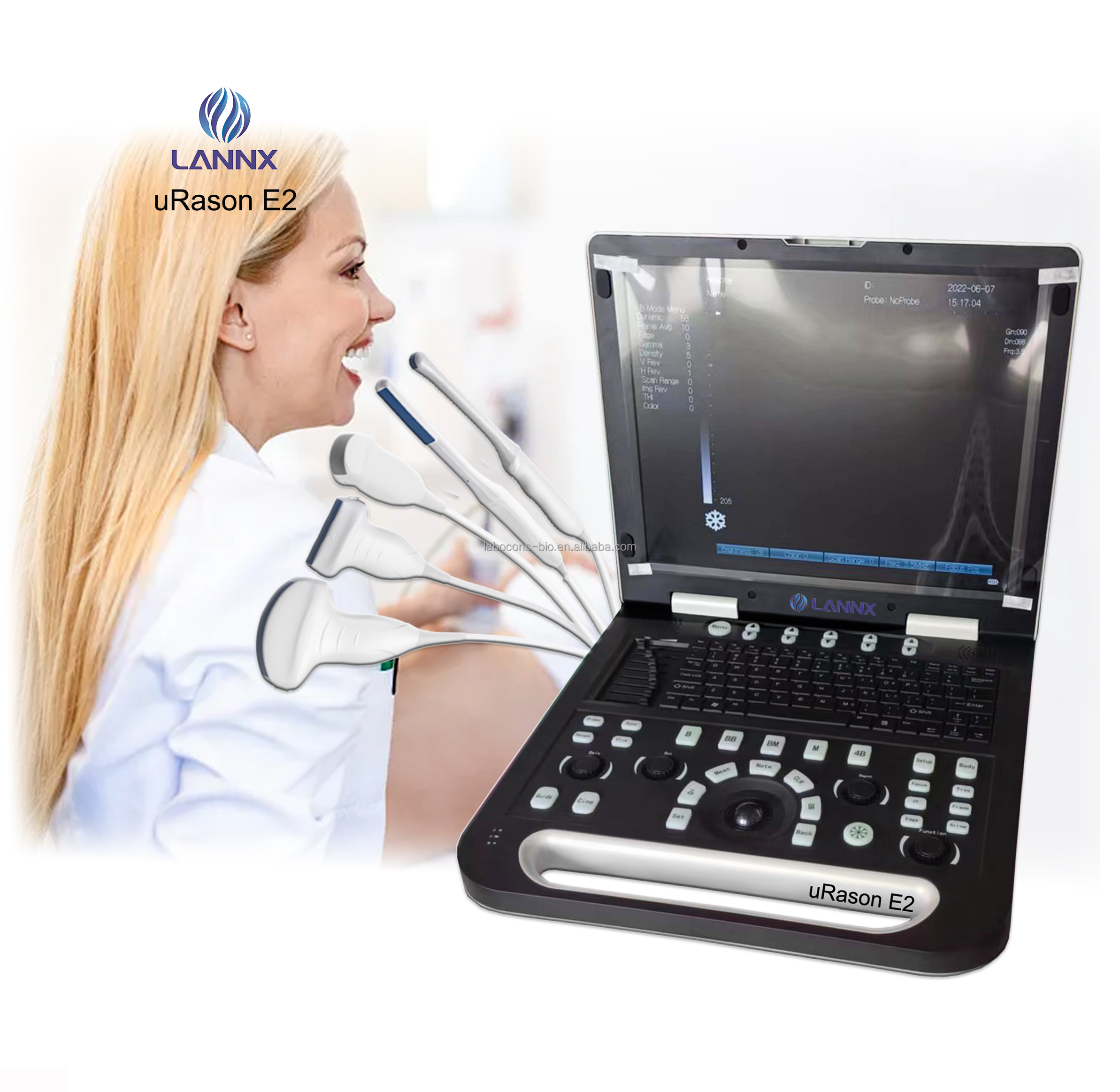 LANNX uRason E2 Medical science Portable Ultrasonic Diagnostic Imaging System 15inch HD LCD display Laptop BW Ultrasound machine