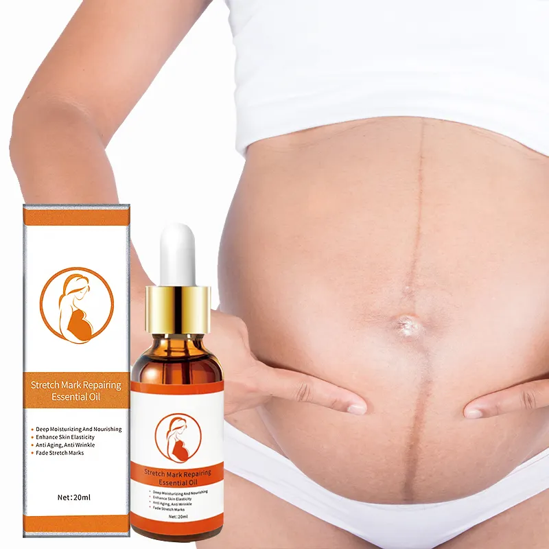 Best Stretch Marks Remover Cream Eliminate Pregnancy Scars removal cream Maternity Repair Anti Winkle Skin Firming Treatment