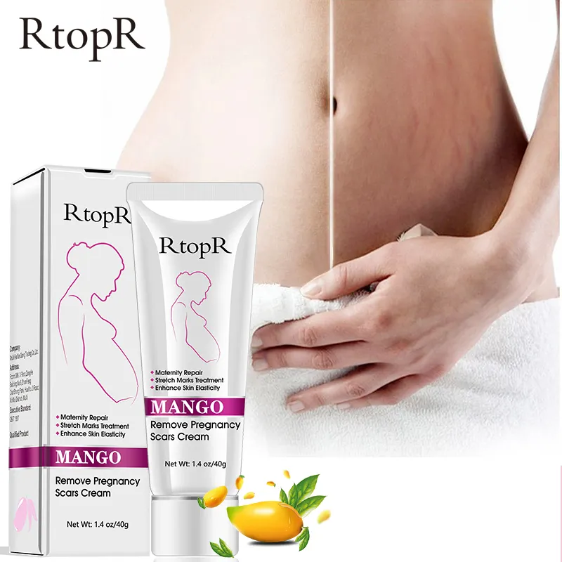 Natural Safety Pregnancy Maternity Repair Anti Aging Anti Winkles Firming Body Skin Care Stretch Mark Cream