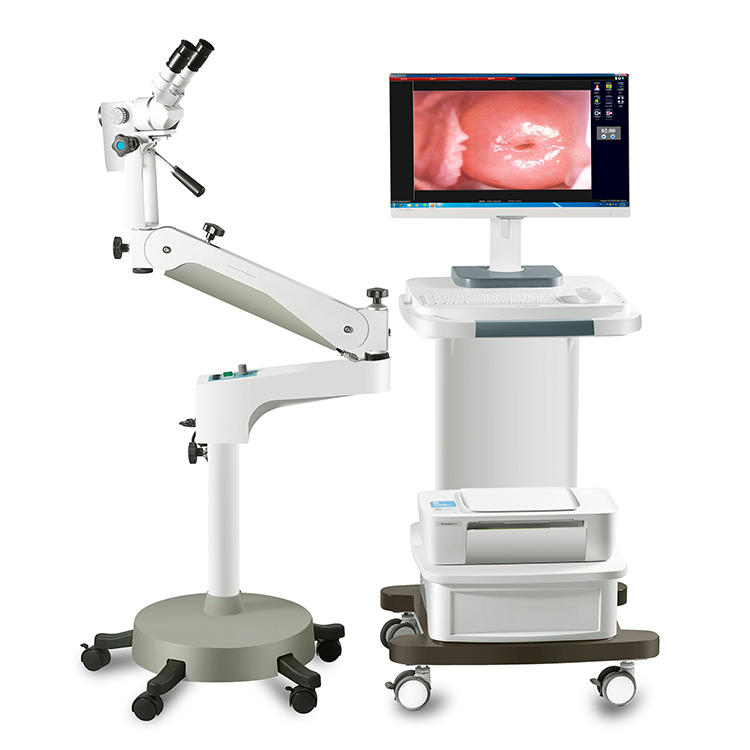 Cheapest Medical Equipment Portable Digital Optical Colposcope for Hospital and Lab