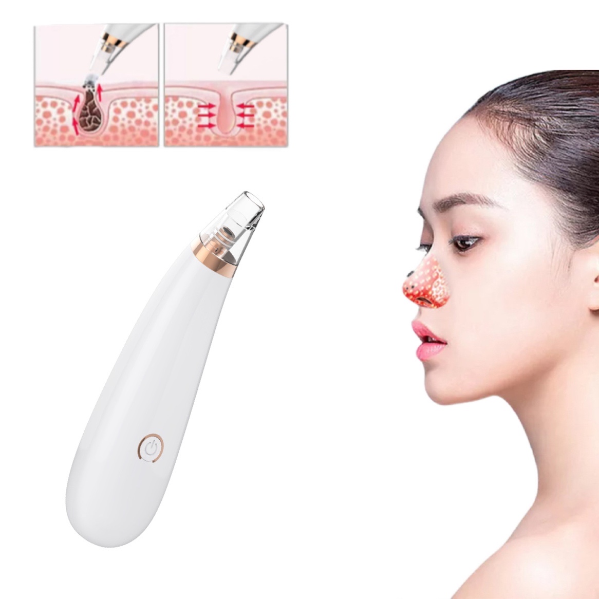 Wholesale Blackhead Remover Kit Pimples Removal Deep Facial Cleaner Pore Vacuum Remover Blackhead