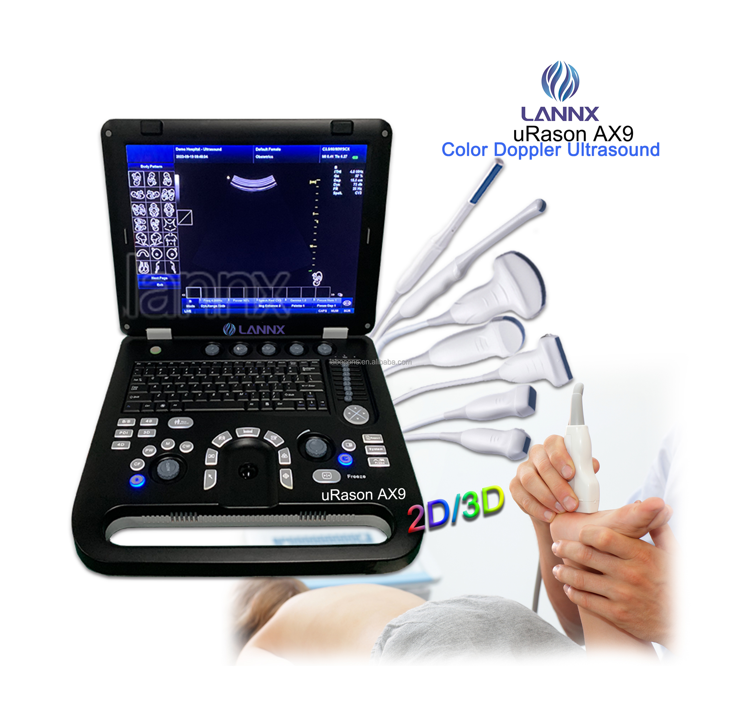LANNX uRason AX9 Factory Price Medical Instruments Color Doppler Ultrasound Scanner Machine 2d / 3d ultrasonic diagnostic system