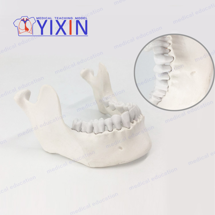 YIXIN/Настраиваемая модель нижней челюсти с зубцами для обучения, Стоматологическая модель зубов