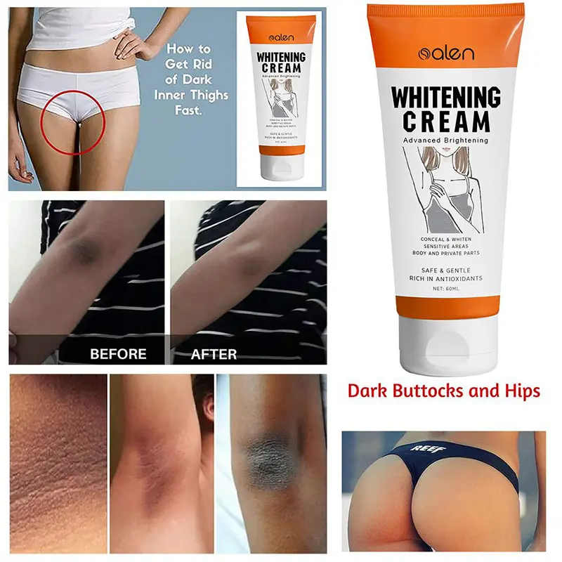 OEM Whitening Beauty Cream Armpit Private parts Elbows Knees Body Moisturizing Smoothing Nourishing Brightening Cream