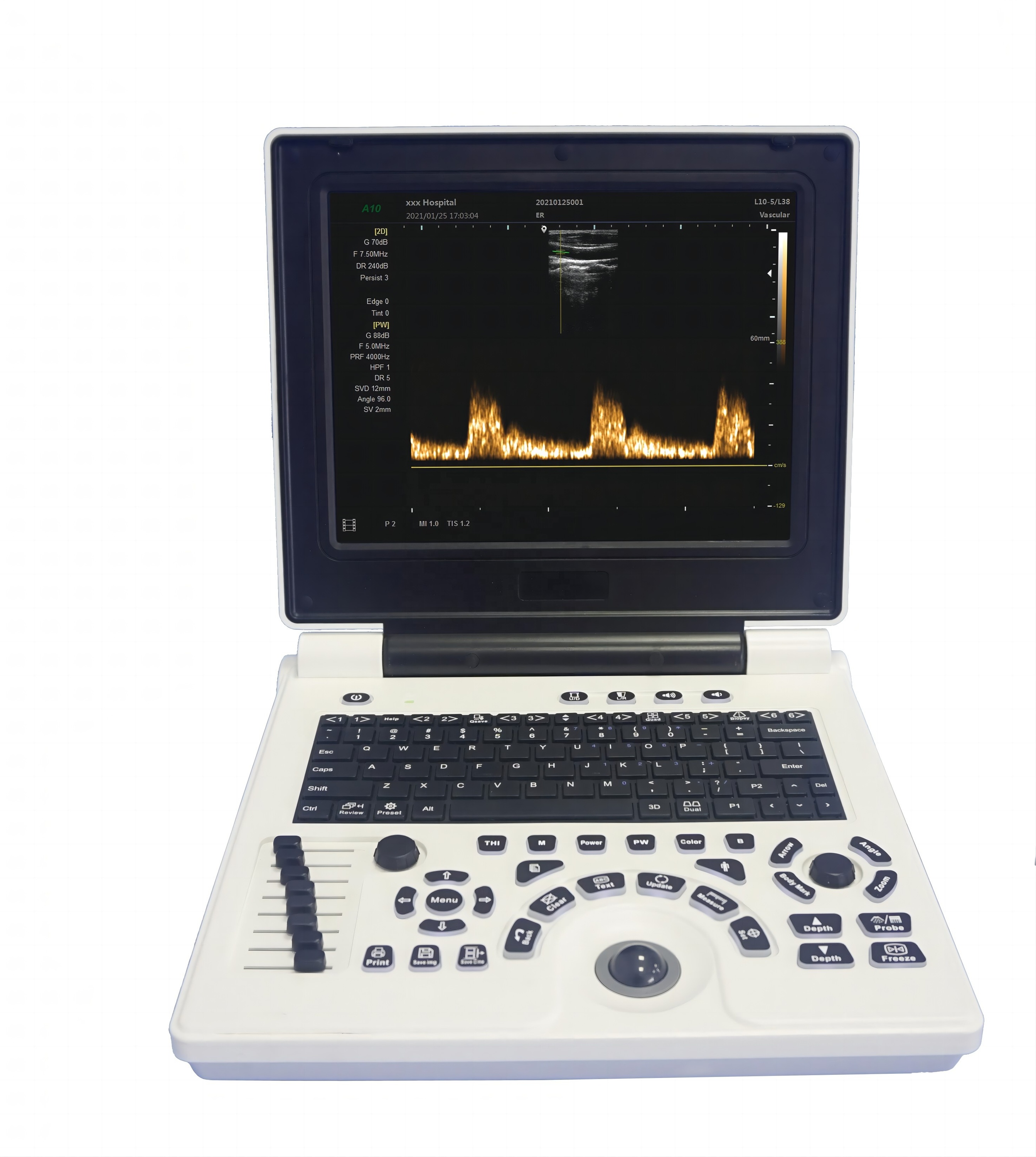DMU03 Best Selling and Portable Medical Use Ultrasound Machine Medical Ultrasound Instruments With Human and Animals