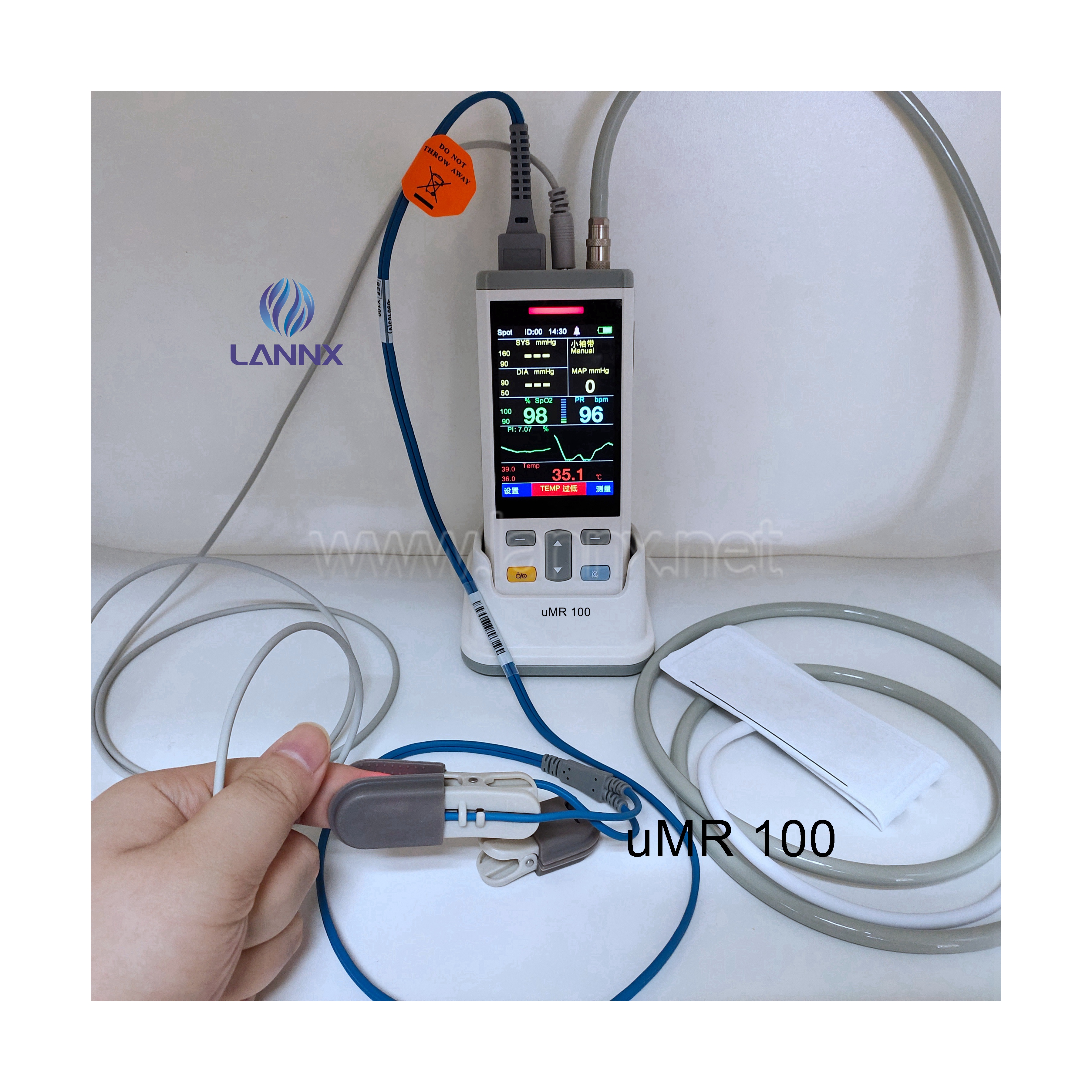 LANNX uMR 100 портативный 3,5 дюймовый Ветеринарный монитор, сенсорный экран для животных