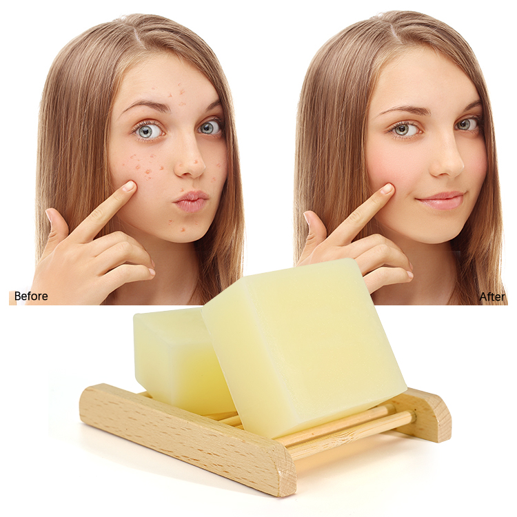 Wholesale Natural Organic Body Bathing Handmade Acne Removal Skin Lightening Base Sea Salt Goat Milk Whitening Toilet Soap