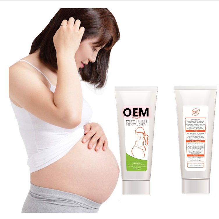 OEM Private label scares and stretch marks cream 100g