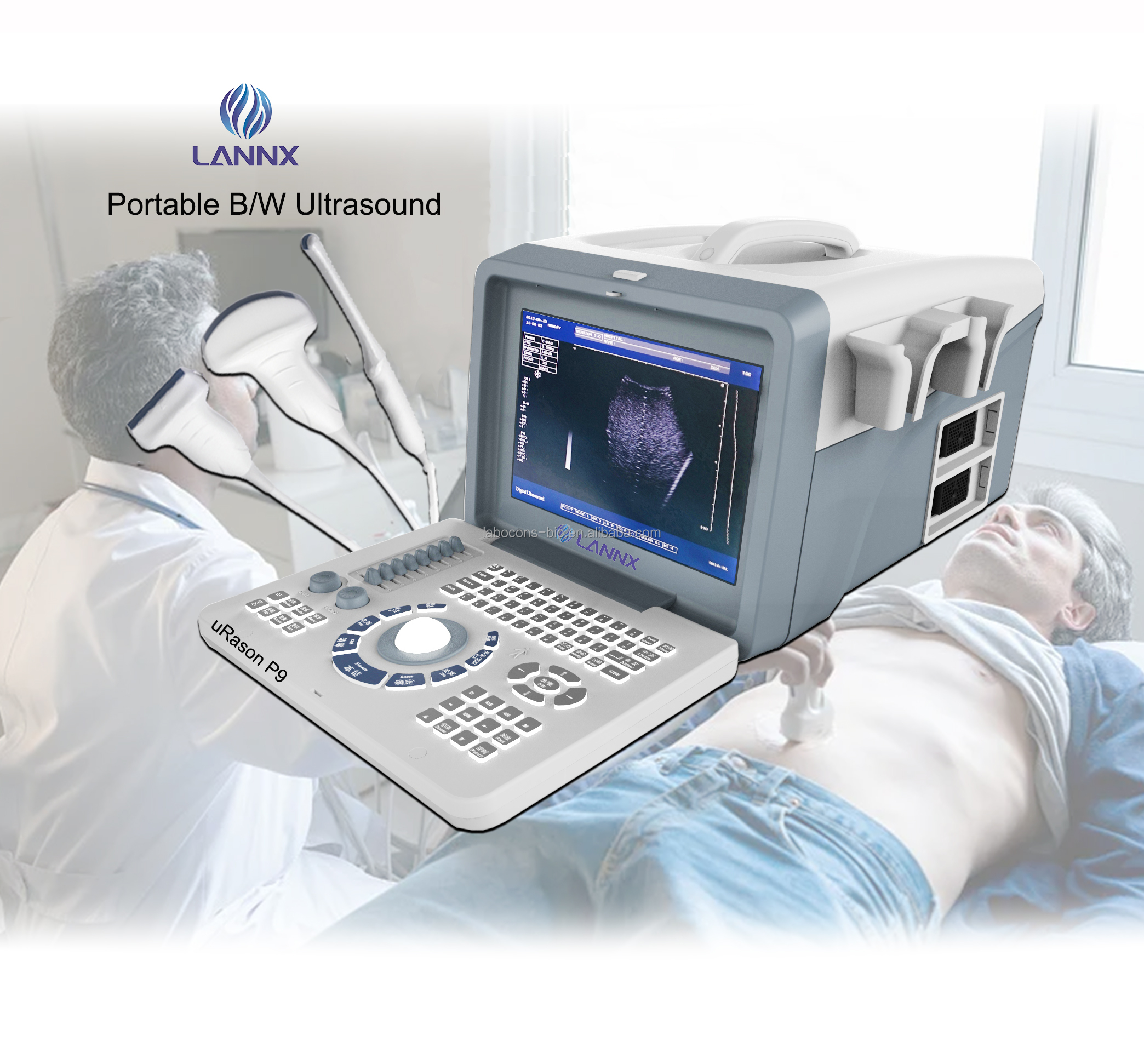 LANNX uRason P9 New designed Full Digital Ultrasonic Diagnostic Imaging System paired with different probes B/W Ultrasound