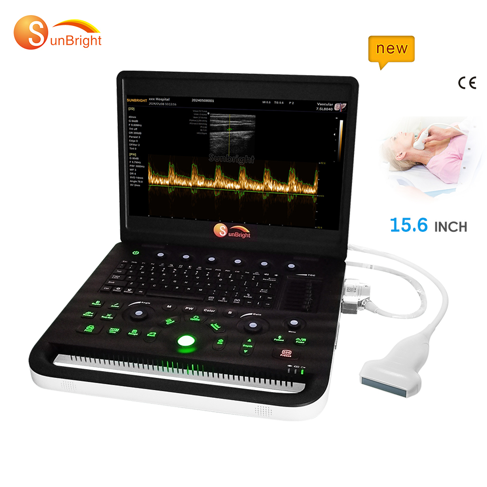 SUN-800C ultra-light PW ultrasound 15.6 inch High resolution ultrasound
