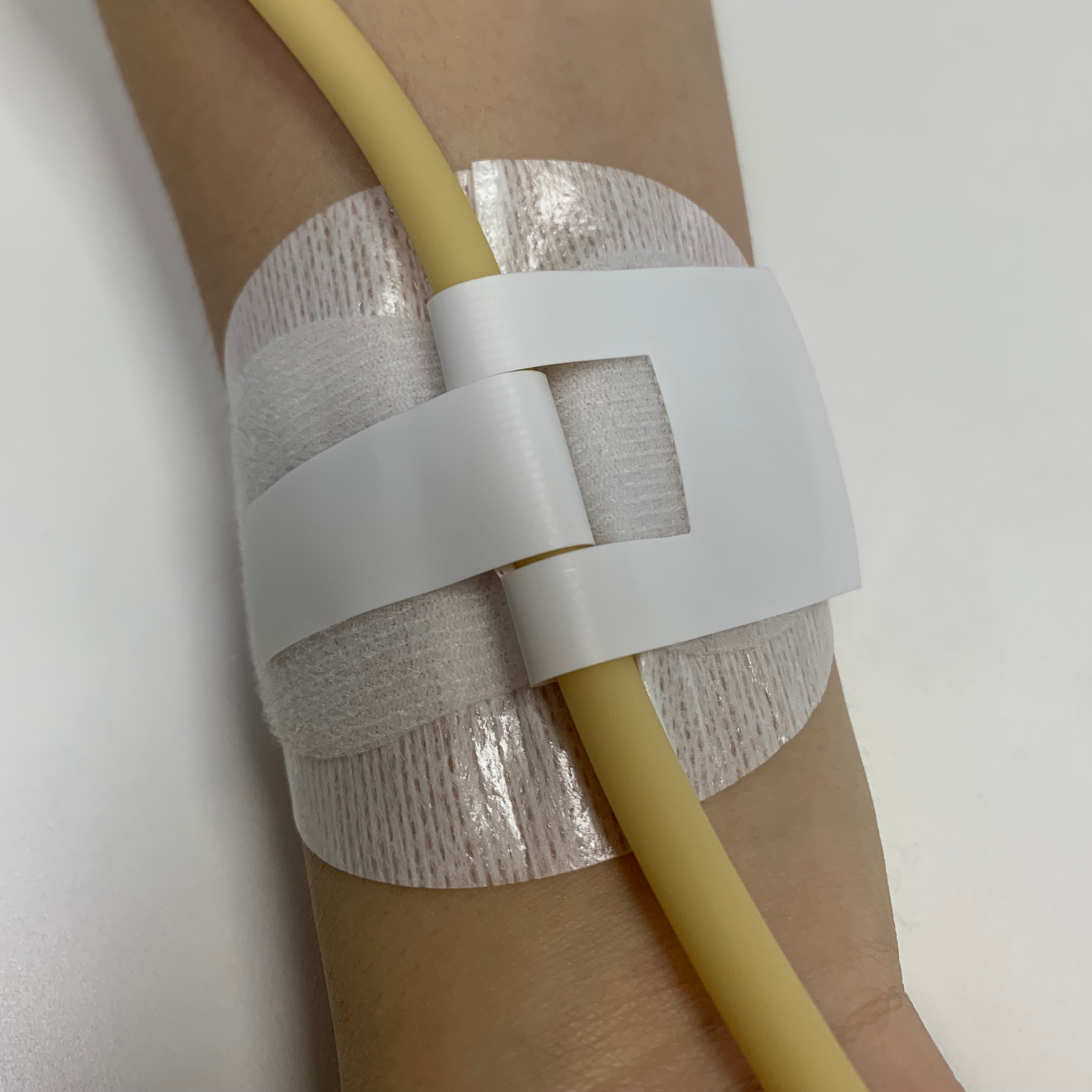 Manufacturer Catheter Fixation Device for Gastric Tube