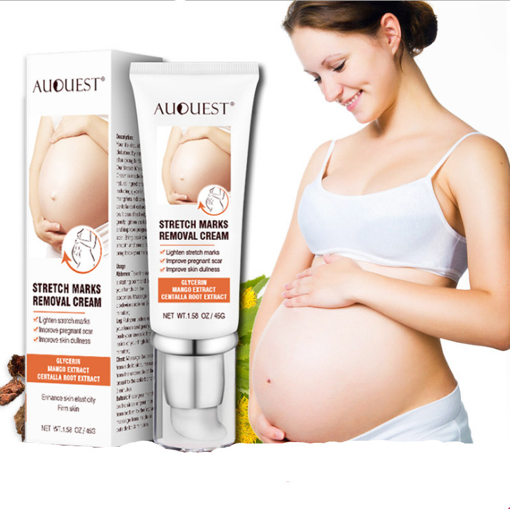 hot sell stretch marks removal cream natural herbal best stretch marks removal cream wholesale