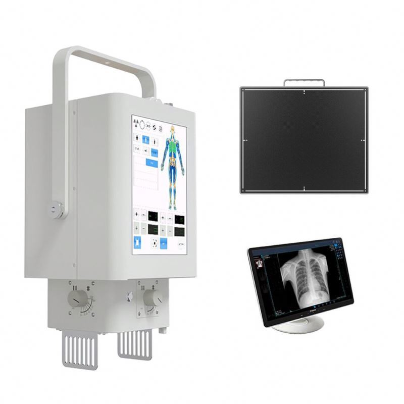 Medical high-frequency equipments xray portable handheld mobile digital x-ray machine for human