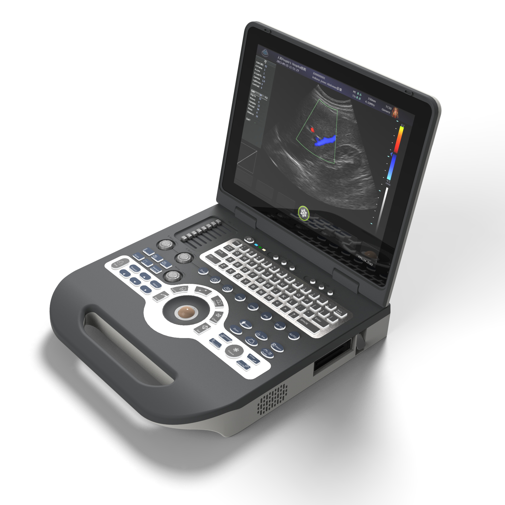 Notebook Color China High Quality Full Digital Ultrasound Scanner