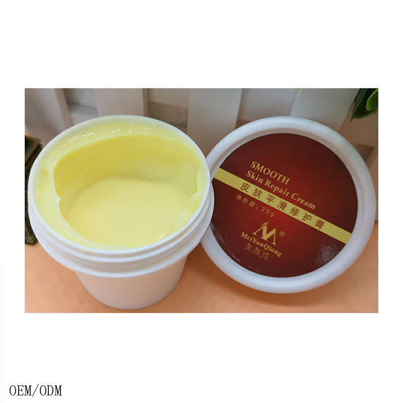 Beauty Care Maternity Stretch Marks Remover Cream Skin Body Postpartum Scar Removal Pregnancy Cream