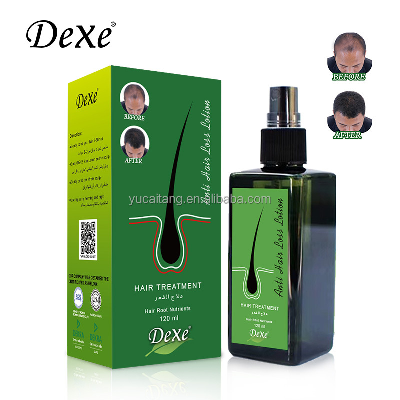 Лидер продаж, органический лосьон для роста волос Dexe, органический спрей для роста волос