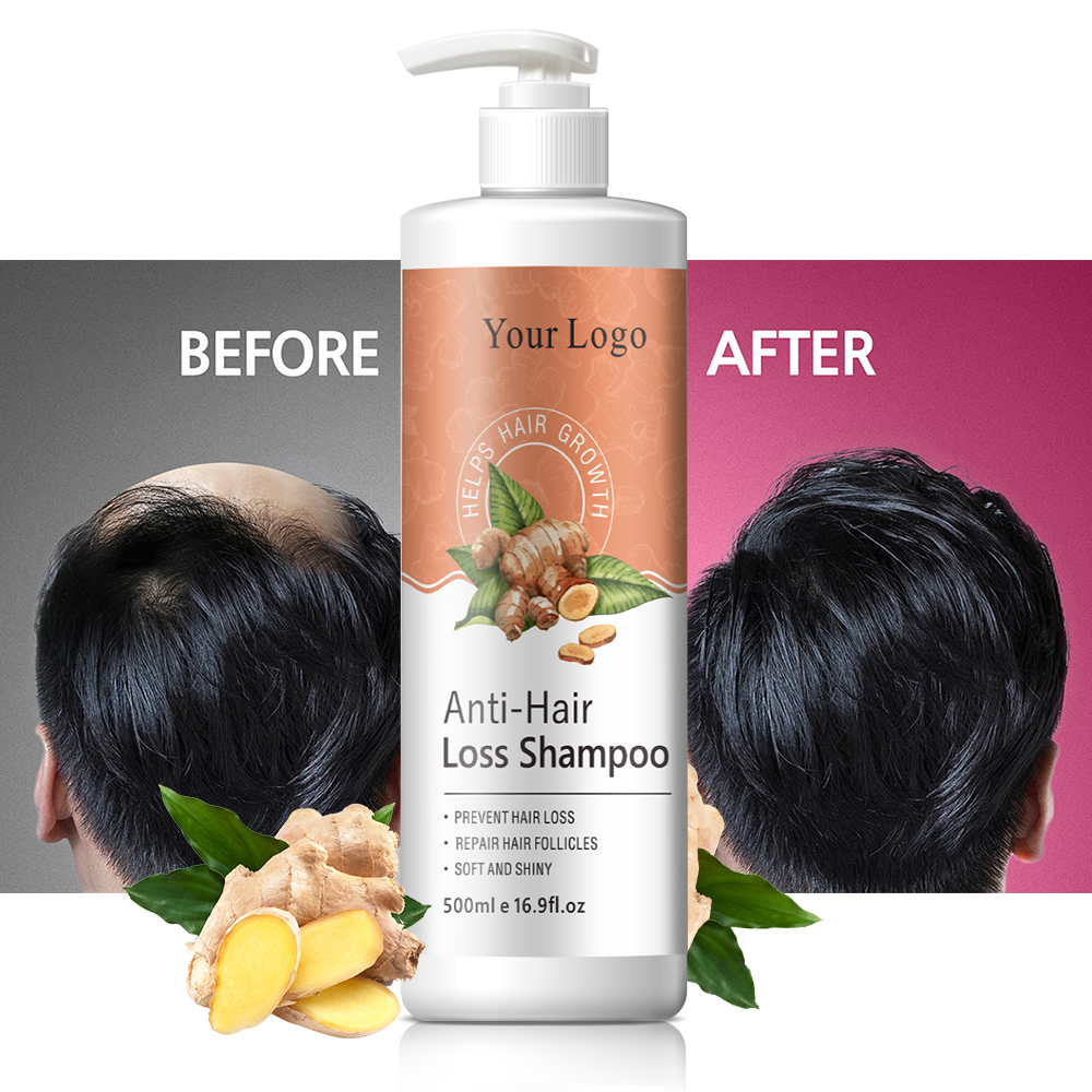 Oem частная этикетка органический Regrowth Dandruff Чистка против выпадения волос кофеин шампунь