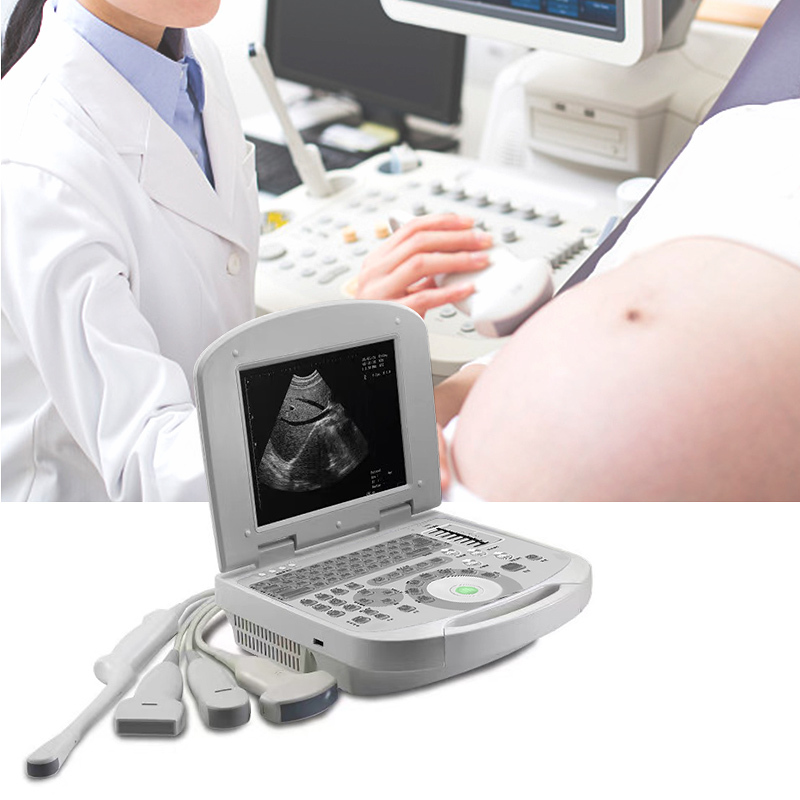 Full Digital Ultrasound Diagnostic System for Human Portable Ultrasound Machine Portable Black & White Ultrasound Notebook Typ
