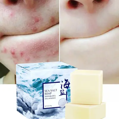 Milk Whitening Herbal Soap Acne Gluta Collagen Face Care Bath Wash Basis Soap Sea Salt Removal Pimple Pores Acne Treatment Goat