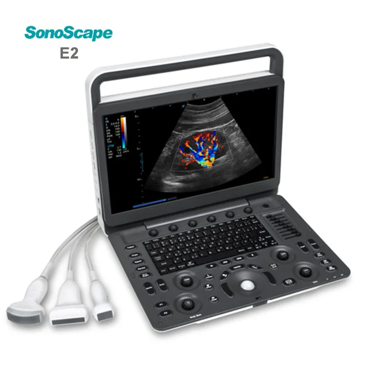 Medical Ultrasound Instruments ecografia portatil Sonoscape E2 Ultrasound Portable Color Doppler Ultrasound Machine