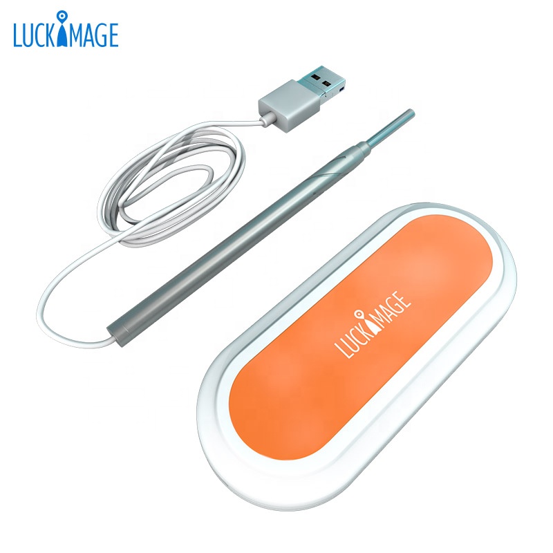 Luckimage самый продаваемый за рубежом беспроводной wifi Отоскоп камера цифровой usb отоскоп