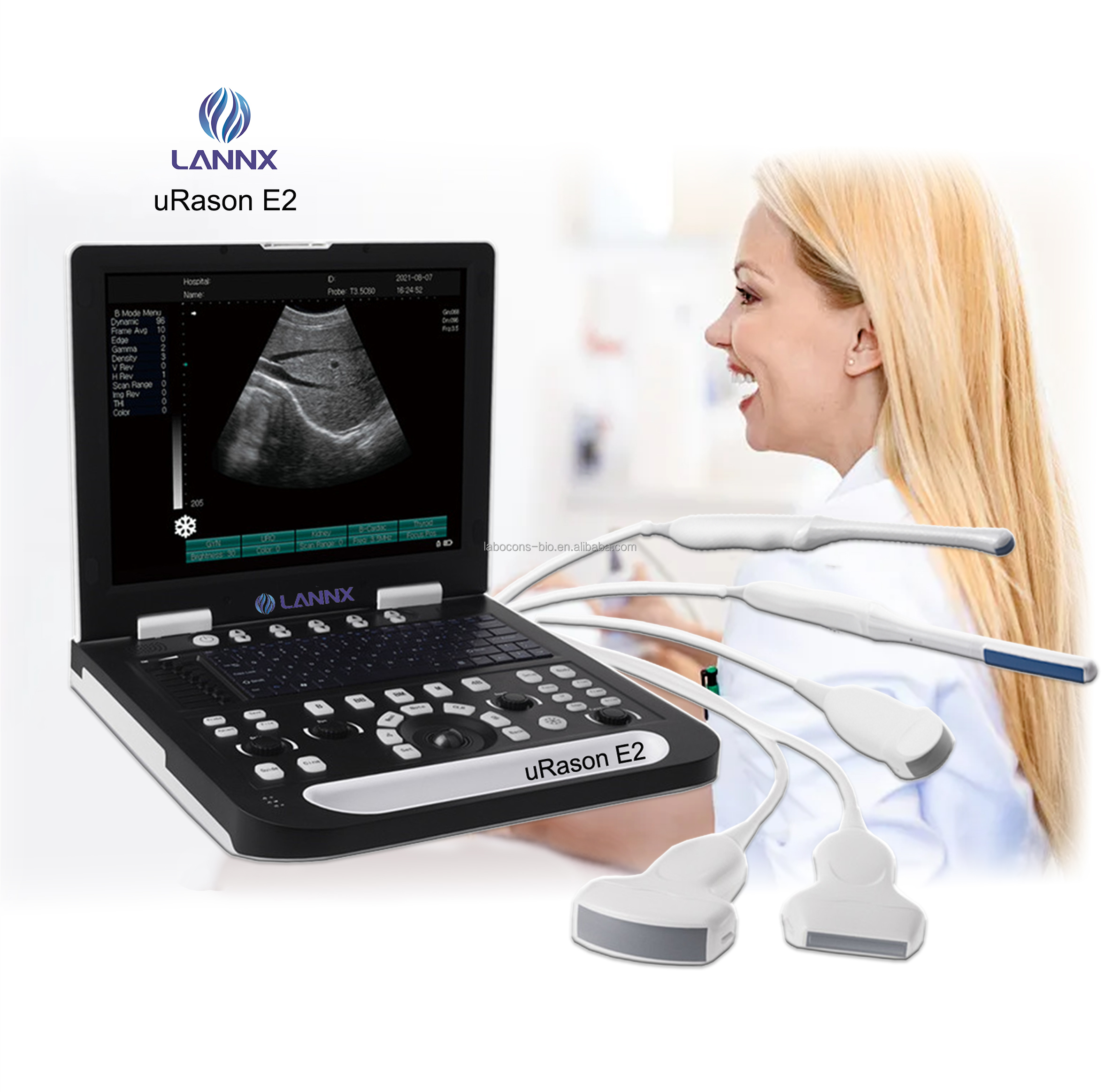 LANNX uRason E2 Factory Made Hospital equipment ultrasound full digital ultrasonic diagnostic device Portable Ultrasonido
