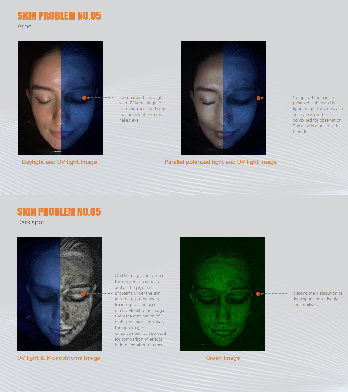 2020 Skin Analyzer Machine/3D Facial Analysis