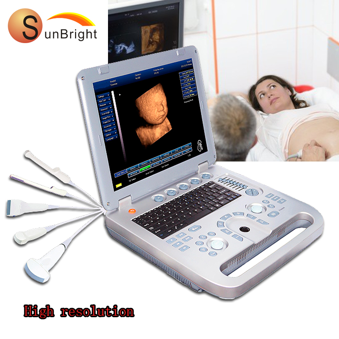 Ноутбук ультразвуковой сканер портативный sonogram 3D ультразвуковая машина для детской беременности Sun-800D