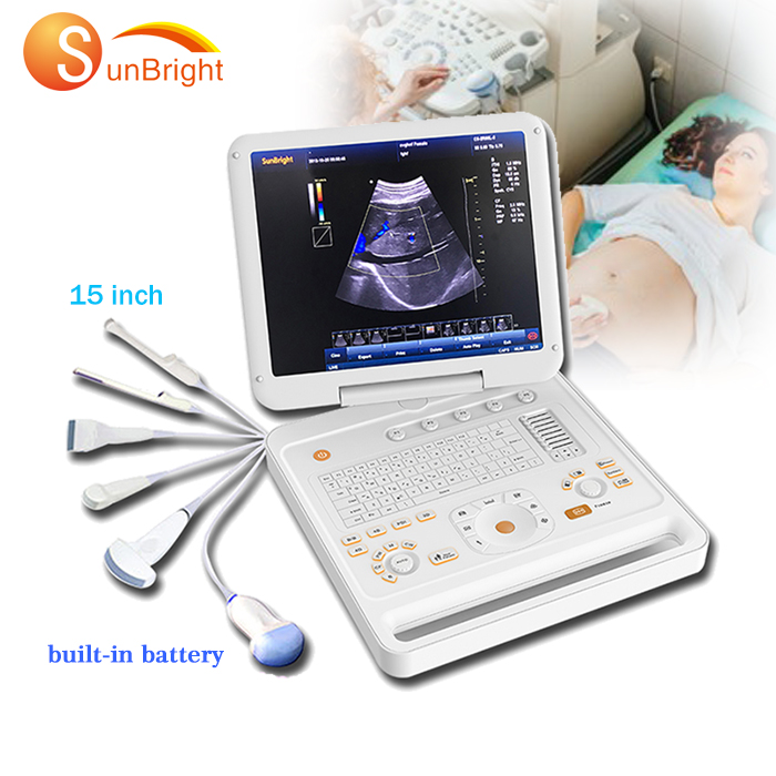 Портативный siemens doppler ультразвук 3d гинекологический/Беременность ultrasounds machine