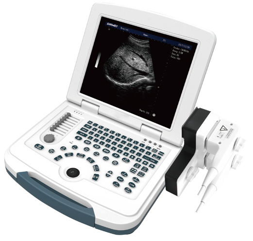 Black & White Ultrasound Machine Full-Digital Ultrasonic Diagnostic System with Electric Power Source