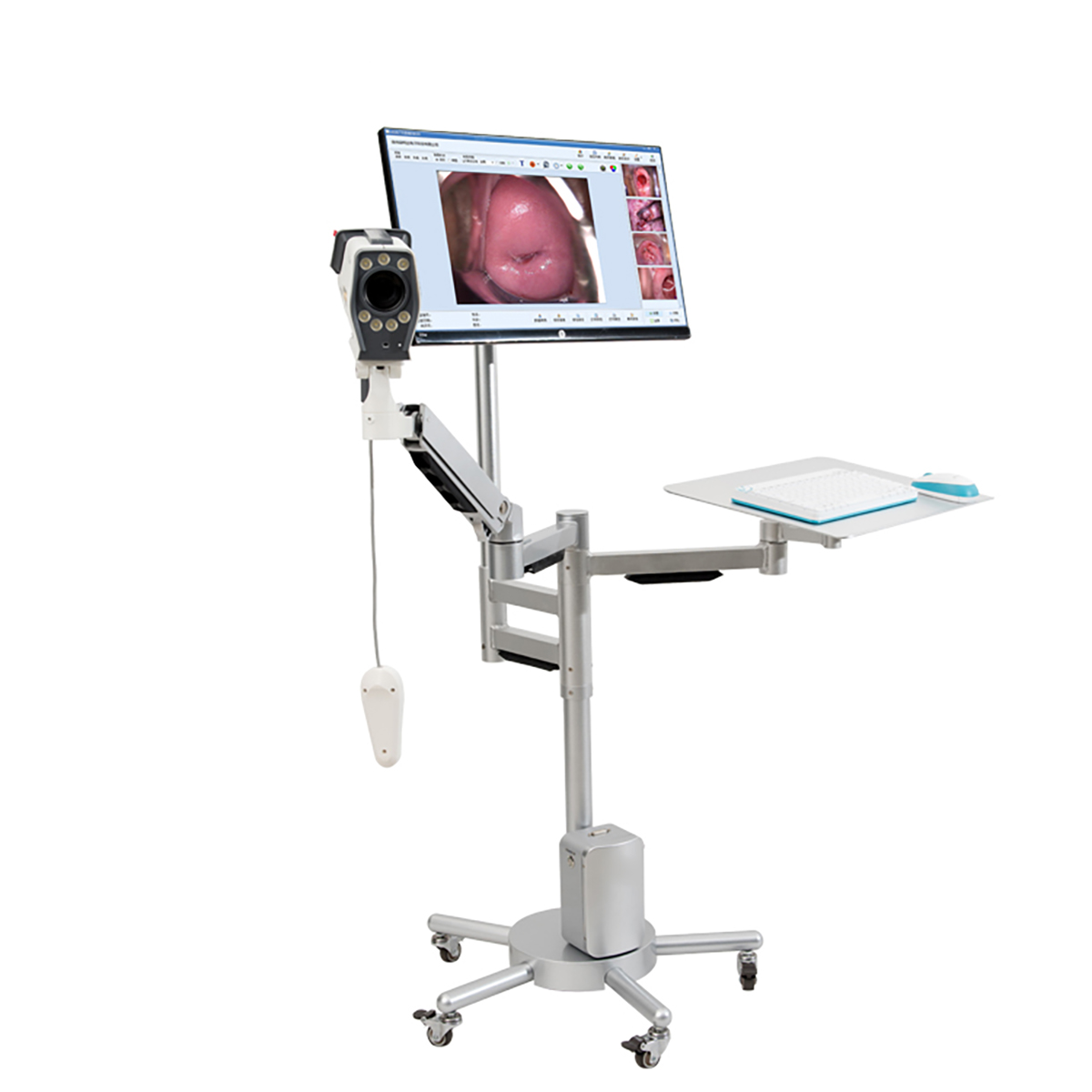 Sony HD цифровое видео Colposcopy/Gyneology оздоровительный Colposcope