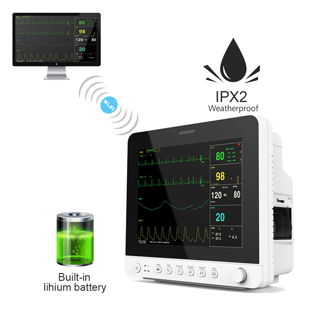 CONTEC монитор пациента vitals monitor со встроенной литиевой батареей монитор пациента настенное крепление