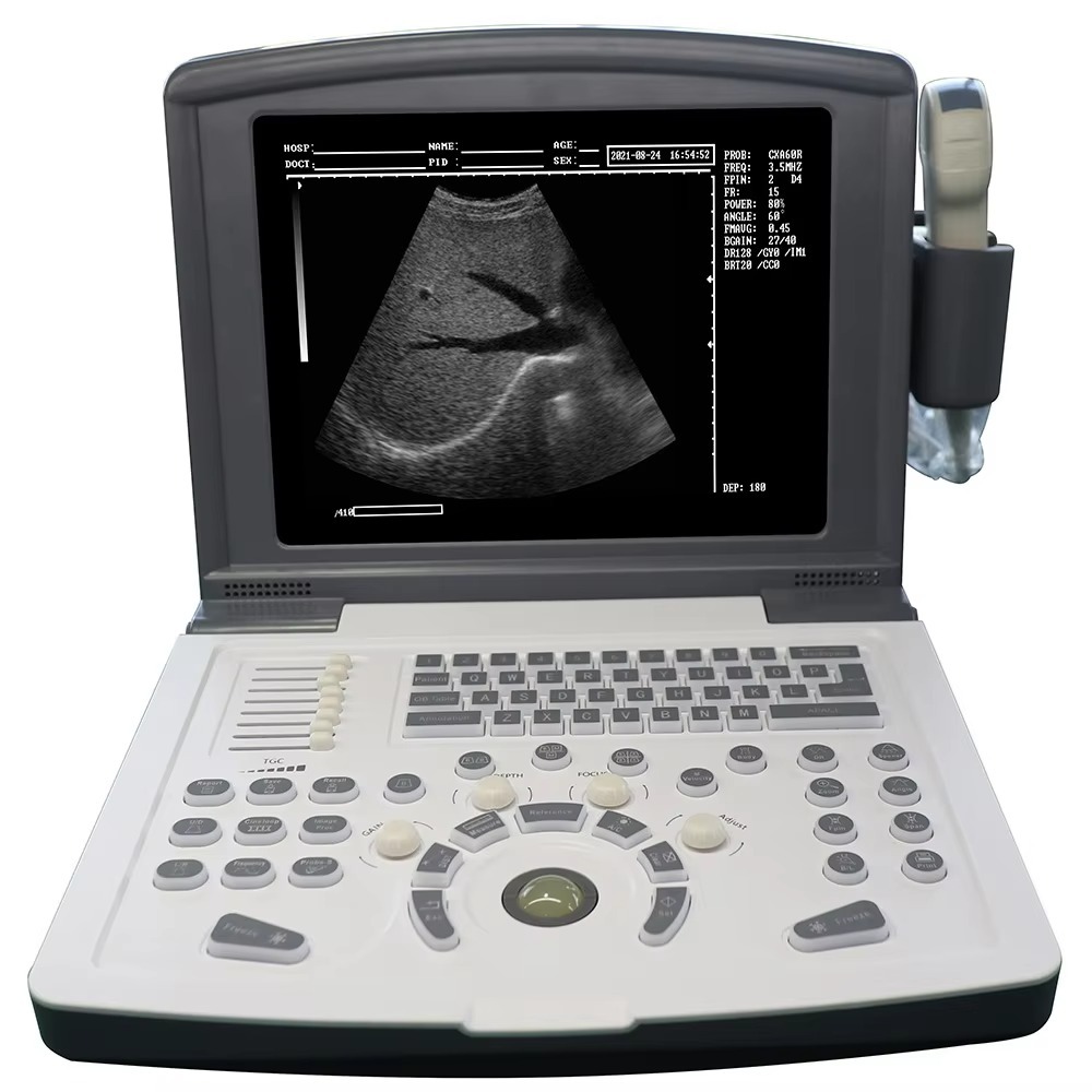 Electric Ultrasonic Scanner Machine for Human/Veterinary Use Medical Ultrasound System with Laptop Interface