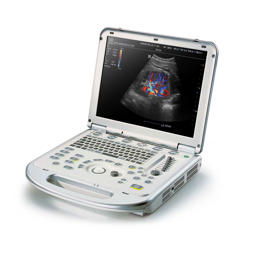 Medical equpment Laptop Color Doppler ultrasound cheaper than Mindray M7
