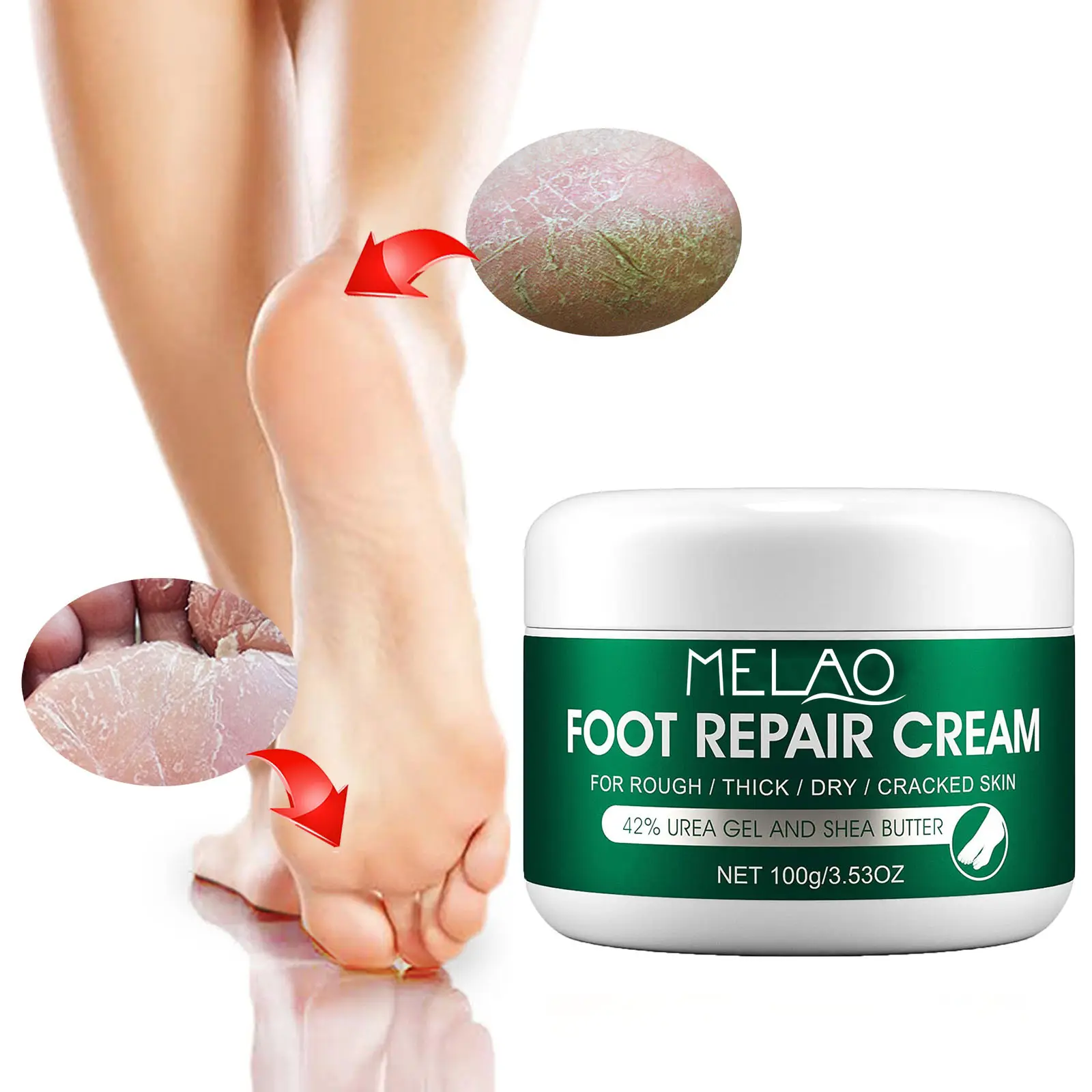 MELAO Private Label Fungi Foot Cream 100% Pure Anti Chapping Whitening Moisturizing Foot Care Dry Crack Heel Repair Feet Cream