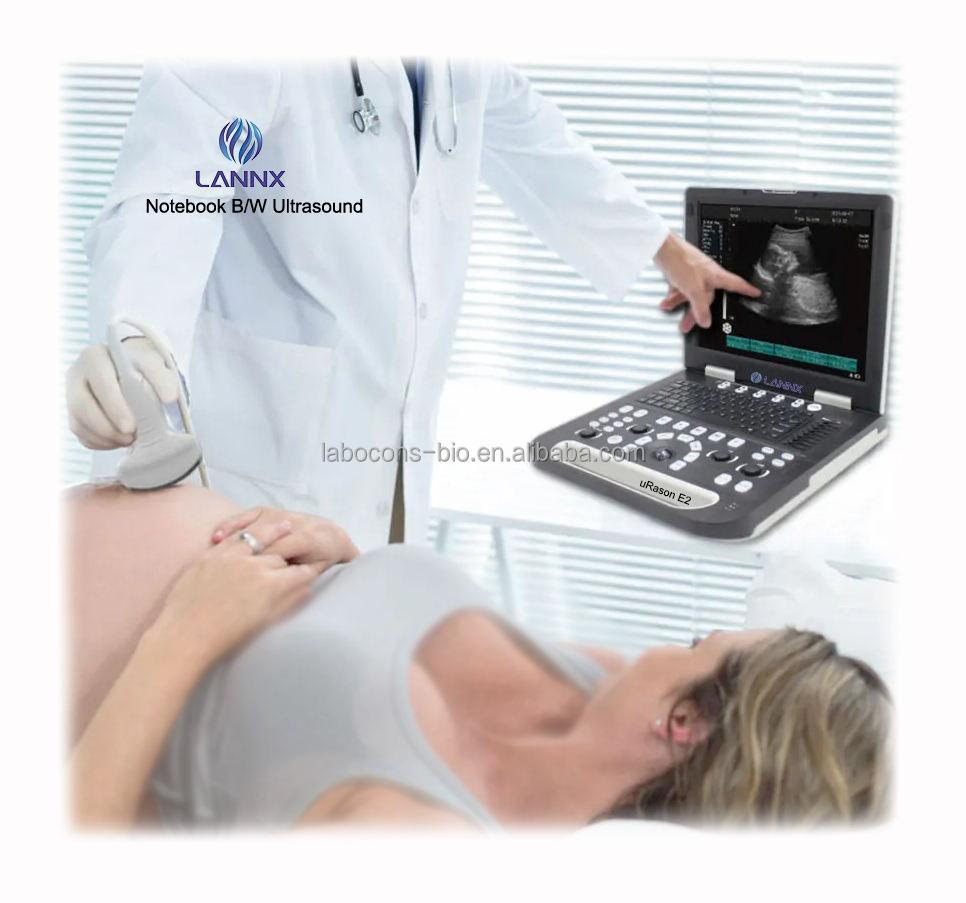 LANNX uRason E2 Economically black and white digital ultrasonic scanner Portable ultrasound scanner device Echography Instrument