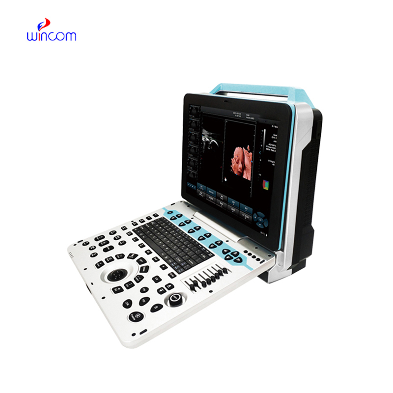 Medical Ultrasound Ultrasonic Instruments Portable Color Doppler 4D Ultrasound Machine