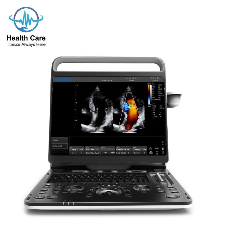Ebit60 Portable Ultrasound Machine Diagnostic Imaging Portable Color doppler Ultrasound Machine Good Quality usg ult