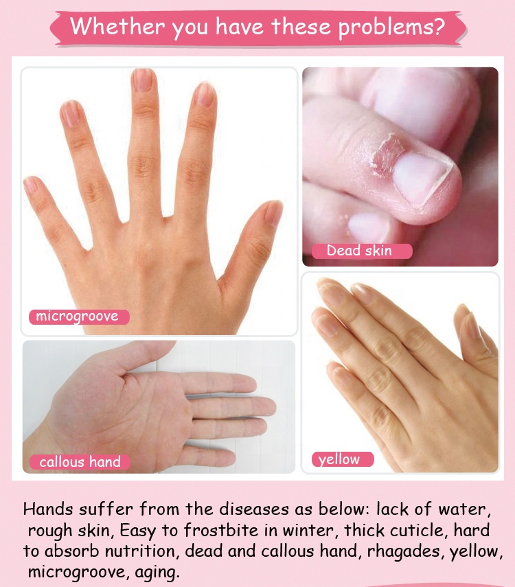 OEM Korea organic private label hand mask glove, увлажняющая глубокая отбеливающая маска для рук