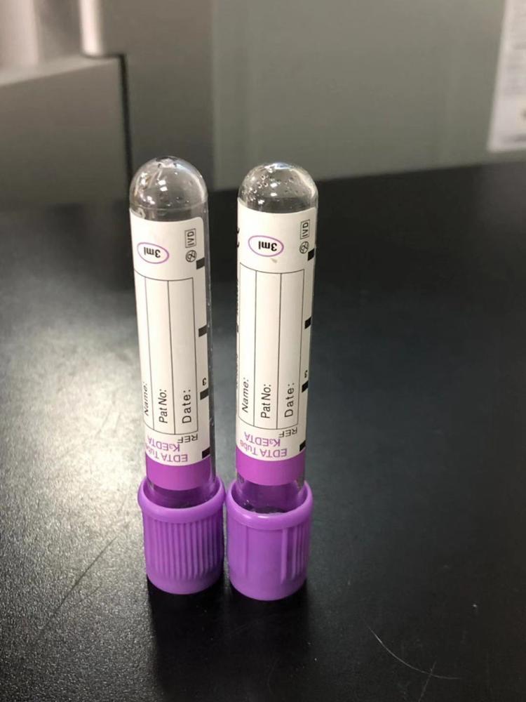 Хорошая цена 13*75 мм пластик 2 мл 5 K2 k3 сыворотка edta антикоагулянт vacutainer вакуум сбора крови трубы для лаборатории