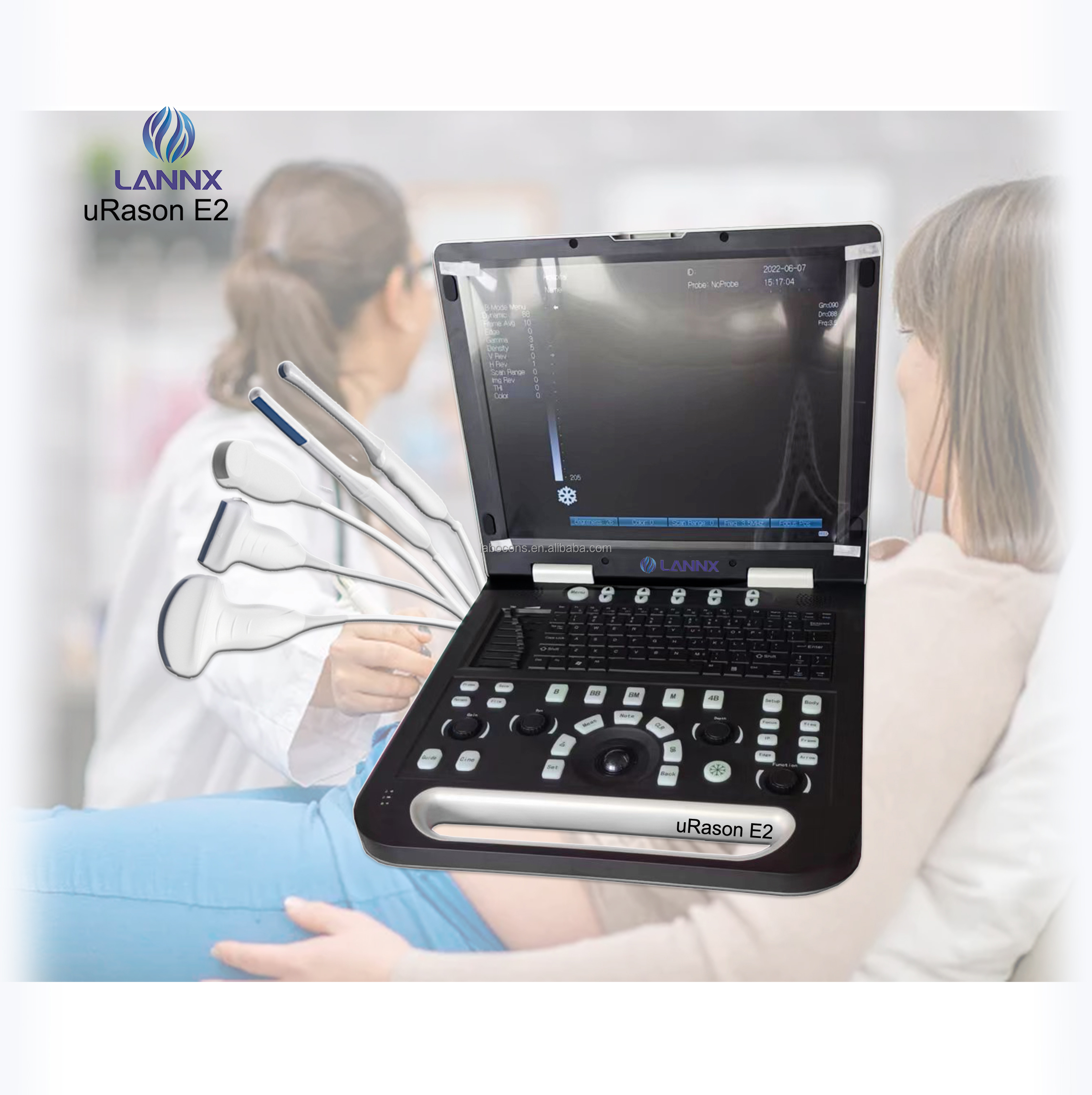 LANNX uRason E2 Full Digital Ultrasonic Diagnostic Imaging System B/W Portable Ultrasound Machine 3D image portable ultrasound