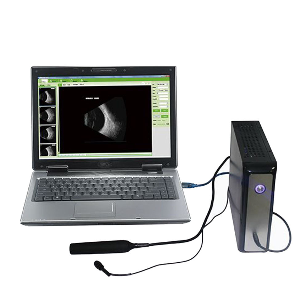 2025 AB scan Ultrasound Ophthalmic Machine Ultrasonic A/B Scanner For Ophthalmology