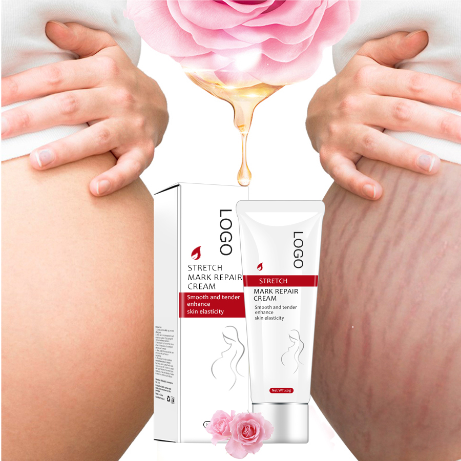 Wholesale Stretch Mark Cream Anti Vergeture Creme Pregnancy Scars Treatment Lotion Skin Care Natural Stretch Mark Removal Cream