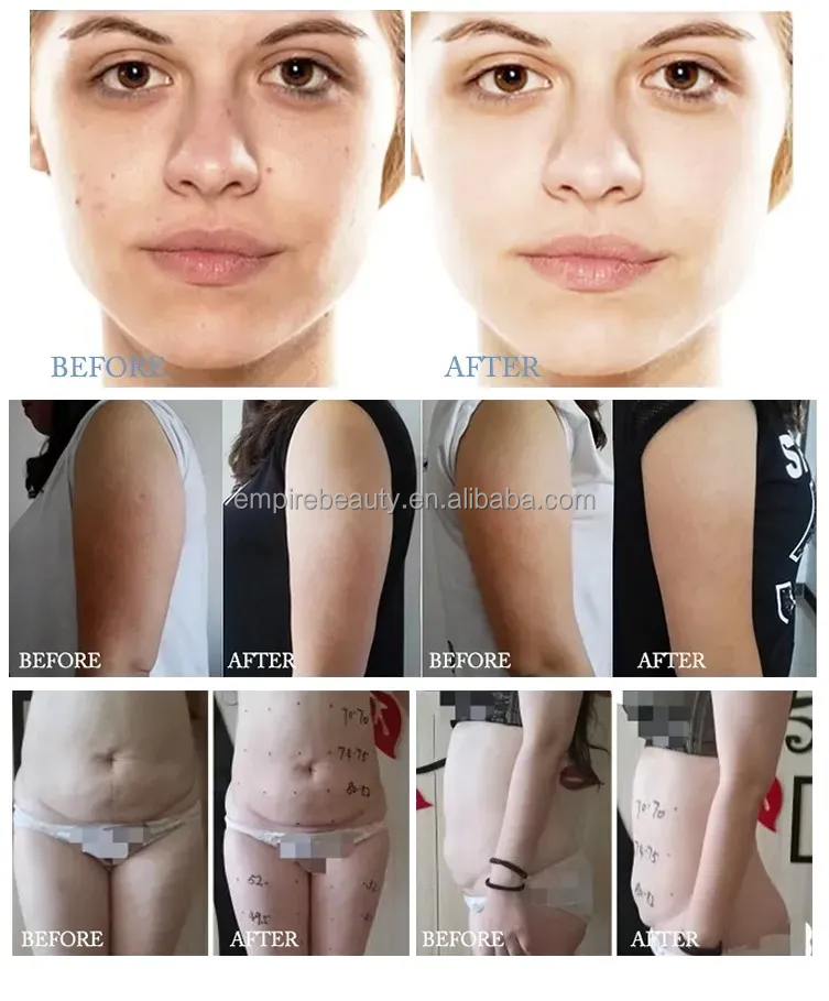 New product face massager Body Sculpting Anti Cellulite Massage Roller Machine Vera Slimming