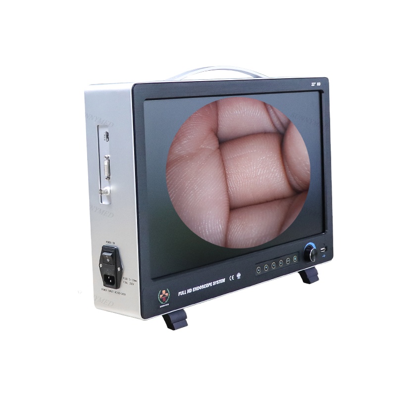 Эндоскоп HD laparascope эндоскоп для Hysteroscopy/артроскоп SY-PS050